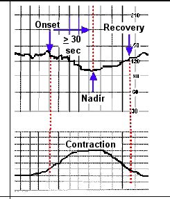 fetal monitoring game|fetal heart tracing quiz.